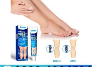Sumifun Varicose Veins Cream In Pakistan